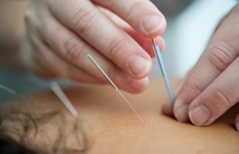 Acupuncture : à chaque mal son remède