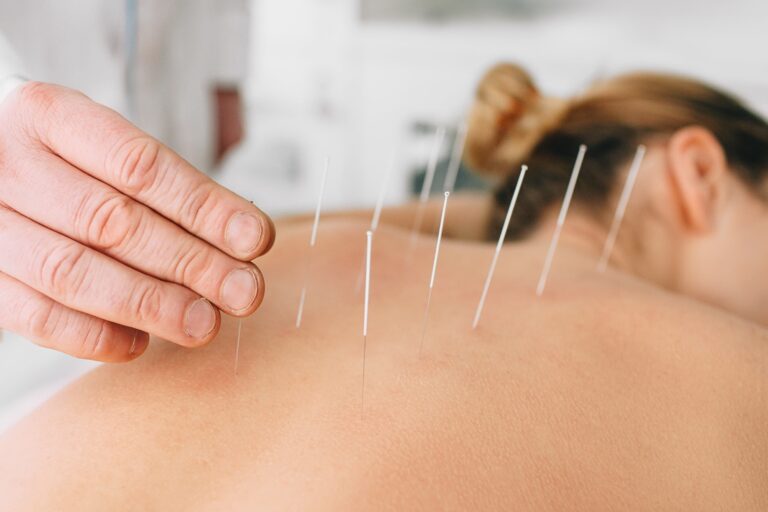 L’acupuncture est-elle le remède miracle pour tout ?